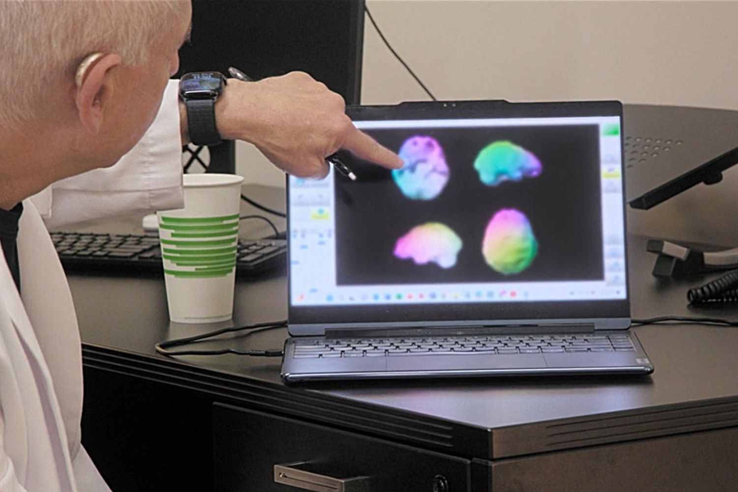 Dr. Daniel Amen showing Kim Kardashian her brain scan results on a laptop, highlighting areas of low activity while she looks on attentively.