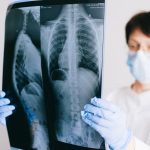 What to Do After a Catastrophic Brain and Spinal Cord Injury in Florida